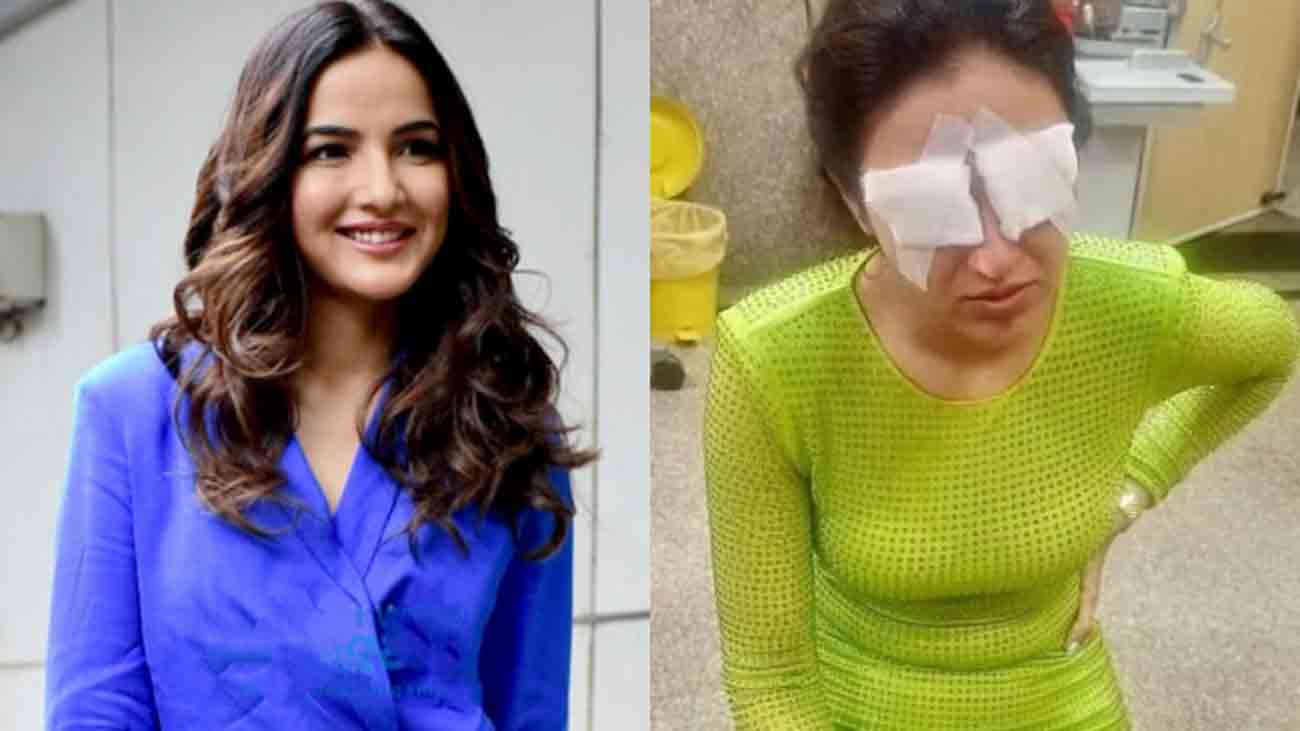 Indian actress says ‘can’t see anything’ after contact lenses damaged eyes