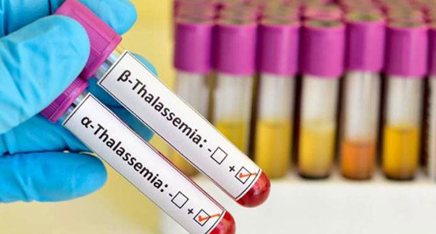 Balochistan makes pre marriage Thalassemia test mandatory Balochistan makes pre marriage Thalassemia test mandatory