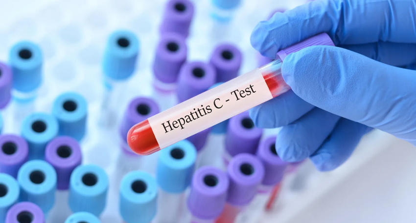 Researchers unveil a 15-minute Hepatitis C test to speed up same-day diagnosis and treatment