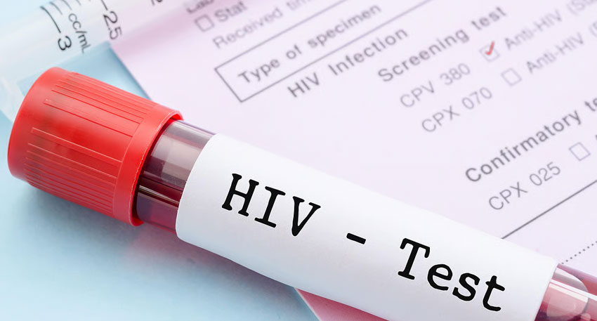 HIV screening Pakistan