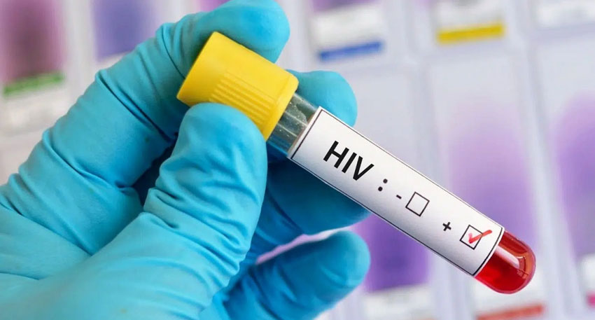 HIV alarm rings in parliament as cases surge nationwide