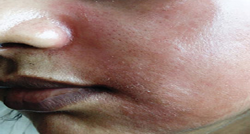 Skin lightening creams increasing health risk