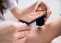 Pakistani doctor creates AI chatbot to detect skin cancer