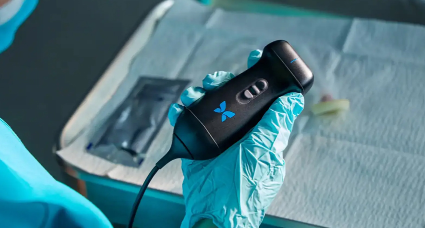 Butterfly Network’s AI-powered ultrasound helps estimate gestational age, improving prenatal care in low-resource areas.