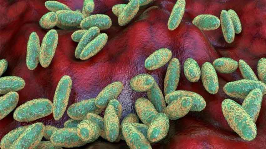 Pakistan says plague risk remains very low after suspected case in Russia. File photo