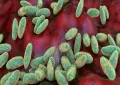 Pakistan assesses plague risk from Russia as health officials issue update